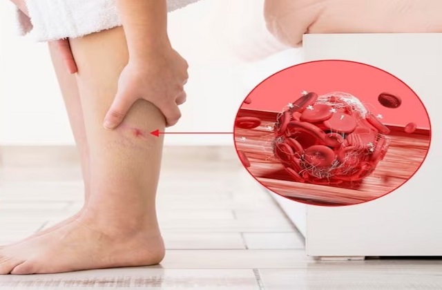 Uric Acid बढ़ने का पहला लक्षण और शरीर पर असर