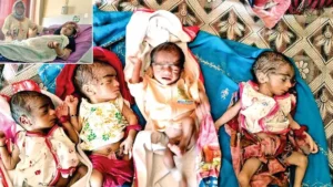 Haryana में महिला ने एकसाथ 4 बच्चों को जन्म दिया