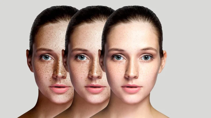 Beauty Tips: ये फेस जेल स्किन को देगा पोषण, चेहरे की झाइयों को जड़ से करेगा खत्म