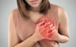 Heart Attack