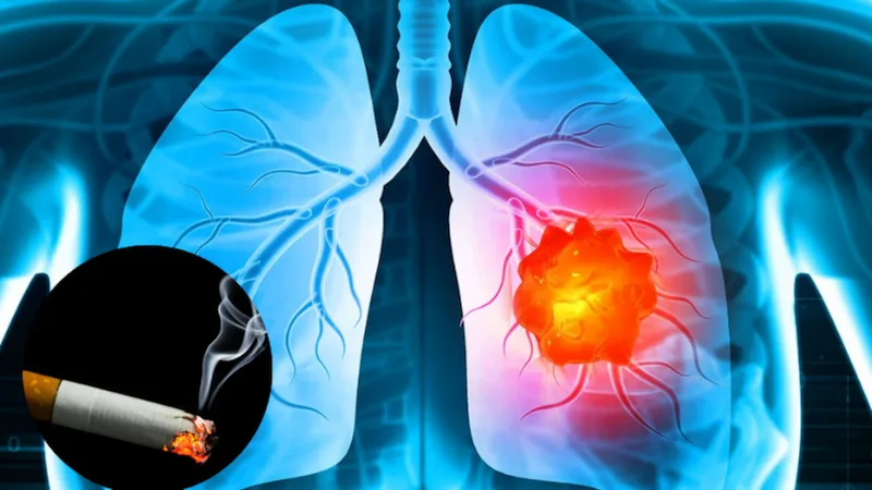Lung Cancer: फेफड़ों का कैंसर बन रहा ‘साइलेंट किलर’, बढ़ रहे डरावने मामले