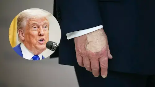 Breaking News: Trump Health: ट्रम्प की बीमारी की अफवाहों का खंडन