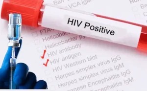 PAK- पाकिस्तान में एड्स बेकाबू, 15 साल में मामलों में 200% से ज्यादा उछाल