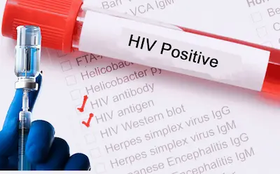 Latest Hindi News : PAK- पाकिस्तान में एड्स बेकाबू, 15 साल में मामलों में 200% से ज्यादा उछाल