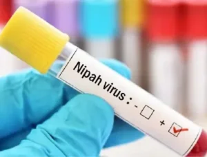 West Bengal -25 साल बाद बंगाल में निपाह वायरस की वापसी, दो नर्सें संक्रमित