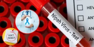 West Bengal- कोलकाता में निपाह अलर्ट, अलीपुर जू में सैंपल जांच, दो नर्स पॉजिटिव