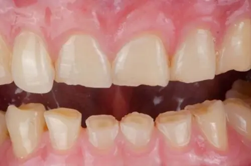 Health- दांतों की सेहत के लिए नियमित चेकअप अनिवार्य- विशेषज्ञ