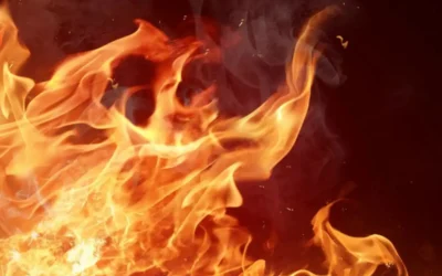 Accident : बेगमपेट में पूजा के दौरान लगी आग