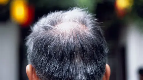 हार्मोनल असंतुलन