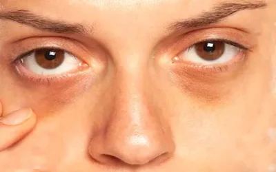 Health- आंखों की समस्या को न करें इग्नोर, हो सकता है गंभीर खतरा