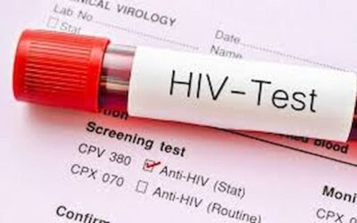 HIV crisis africa : हर चार में एक को HIV, देश में गंभीर हालात