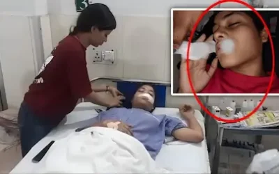 आवारा कुत्ते ने 20 साल की युवती पर किया हमला