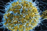 Ebola Virus Alert : वाराणसी में स्वास्थ्य विभाग अलर्ट, बढ़ाई गई निगरानी