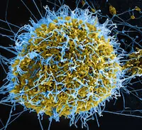 Ebola Virus Alert